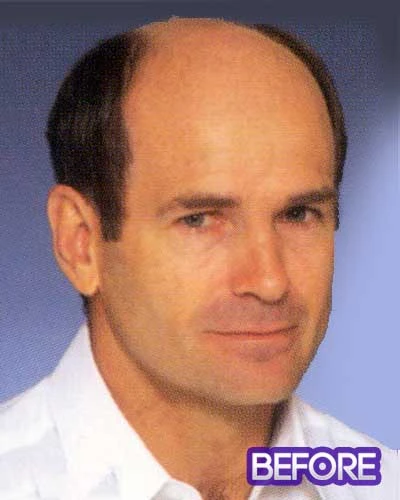 Ready To Wear | Men's Hairpiece By Leading Man Toupee For Men